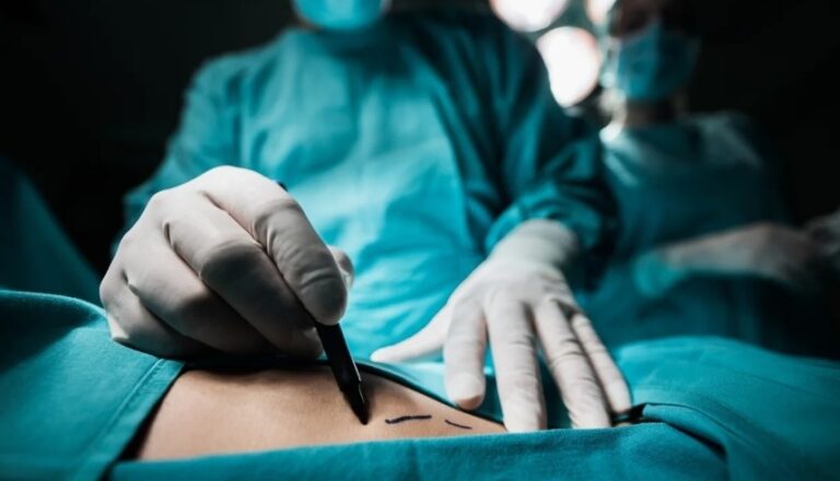 جراحة تتحول إلى فضيحة.. طبيب يستأصل كبد مريض بدل الطحال “بالخطأ” صورة تعبيرية