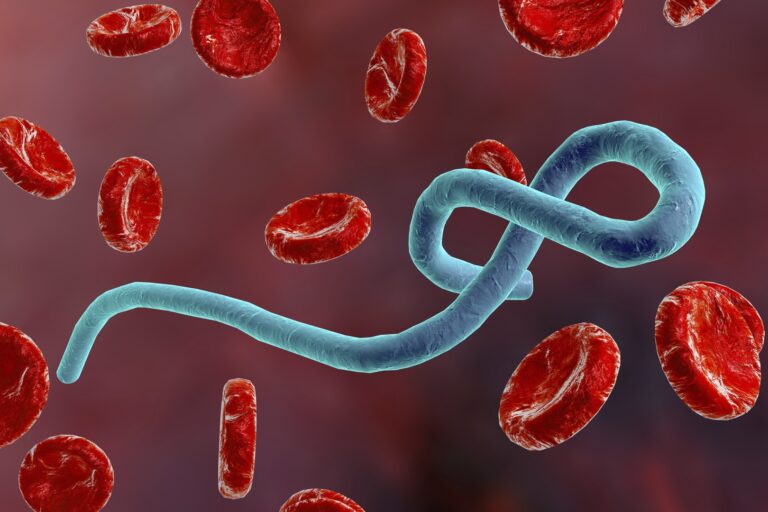 علامات مبكرة للإيبولا يمكن الخلط بينها وبين الإنفلونزا